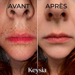 Keysia Sérum - Stop naturel à la pousse des poils