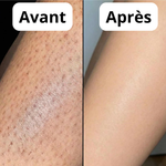 Keysia Sérum - Stop naturel à la pousse des poils