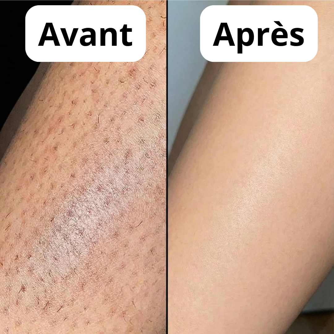Keysia Sérum - Stop naturel à la pousse des poils