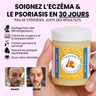 Keysia Skin — Le Baume Réparateur Anti-Eczéma...