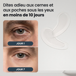 Patchs Microneedle | Nouvelle Génération